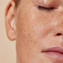 Nahaufnahme eines Gesichts mit Sommersprossen. Die Haut wirkt frisch und strahlend, was auf die positive carnosin wirkung hindeuten könnte.