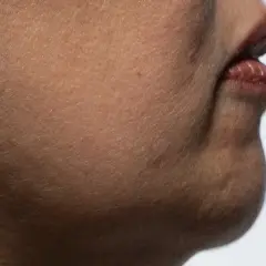 Nahaufnahme der Haut mit feinen Härchen und Lippen. Die alpha arbutin wirkung kann hier zu einem ebenmäßigeren Hautbild beitragen.