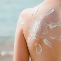 Sonnenschutz auf dem Rücken eines Kindes, geformt wie eine Sonne. Die astaxanthin wirkung schützt die Haut vor der Sonne.