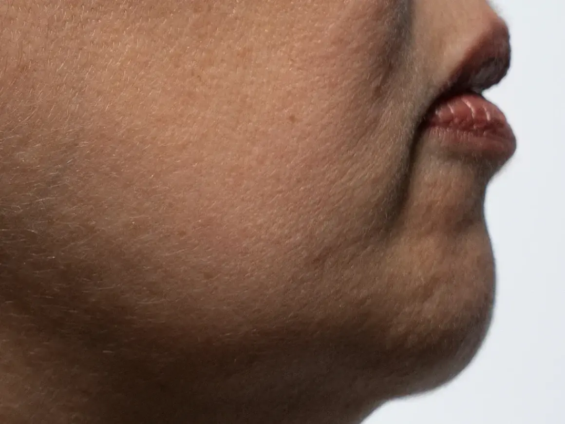 Nahaufnahme der Haut mit feinen Härchen und Lippen. Die alpha arbutin wirkung kann hier zu einem ebenmäßigeren Hautbild beitragen.