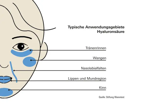 Hyaluronsäure Wirkung - was Serum, Creme und Filler leisten
